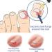 German ToenailPlus Anti Paronychia Relief Oil - Repair Damaged Nails (2 Pcs) - Buy Online on GoSupps.com