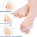 Hoogoo Bunion Toe Corrector Pads 8Pcs - Toe Separator and Spreader for Overlapping Toes - Gel Bunion Cushions for Women and Men - Buy Online on GoSupps.com