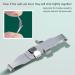 2-Piece Set Stainless Steel Ingrown Toenail Corrector Ingrown Toenail Correction Buckle Paronychia Correction Tool Repairing Nails That Grow Inward to Improve Their Shape and Reduce Pain - Buy Online on GoSupps.com