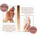 Acanthosis Nigricans Huile de th rapie pour corriger les taches sombres traitement de l'acanthose nigricans limine les taches sombres pour claircir le corps et la peau noire (1 pi ce) 1 pi ce. - Buy Online on GoSupps.com