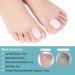 RooRuns Toe Separators for Overlapping Toes & Bunions - Gel Orthopedic Bunion Corrector & Relief - Large Size (3 Pair) 6pcs White - Buy Online on GoSupps.com