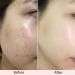 Paris CR ME d ALBAROSA EXCELLENCE | Melanin Care Cream for Clearer & Rejuvenated Skin | Prevent Breakouts & Blemishes | All Skin Types | 2.63 fl. oz (75ml) - International Shipping Available - Buy Online on GoSupps.com