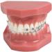 Dental Teeth Model - Orthodontic Study Tool with Metal & Ceramic for Demonstration - Buy Online on GoSupps.com