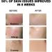 Wormwood Facial Oil - 100% Natural Essential Oils Moisturizing 10 mL | Shop Internationally - Buy Online on GoSupps.com