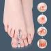 Feelsploh Toe Valgus Relief - 2 Piece Elastic Soft Iron for Hallux Protection & Daily Comfort - Non-Slip Foot Accessories - Buy Online on GoSupps.com