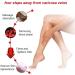 Mediginger Anti-Swelling & Cellulite Firming Ointment for Legs (5PCS) - Buy Online on GoSupps.com
