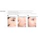 MustaeV Spot Eraser Concealer Pencil - No. 05 Neutral Beige - 1 Count - Buy Online on GoSupps.com