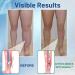 Healsox Tourmaline Anti-Edema Compression Socks - Self-Heating Magnetic Foot Massage Thermotherapeutic Health Socks (2 Pairs) - Lose Weight & Improve Wellness - Buy Online on GoSupps.com