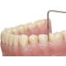 ReinerDENT3 Sensitive Denture Cleaner 100ml - Allergy-Friendly for Peek & Bio HPP Dentures - Buy Online on GoSupps.com