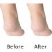 Yucool 4-Pack Foot Pumice Stone & Exfoliator Set | Callus Remover Scrubber with Stainless Steel Riper & Nail Files - Perfect Pedicure Essentials - Buy Online on GoSupps.com
