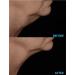 N.E.C.K Control: Neck Lifting Firming & Retracting Cream - Best Anti-Aging Solution for a Youthful Neck | Shop Now Internationally - Buy Online on GoSupps.com