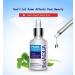 BIOAQUA Face Acne Treatment | Scar Removal & Pimple Moisturizer | Essential Oil 30ml - International Shipping - Buy Online on GoSupps.com