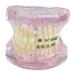 Tooth pattern dental orthodontic studio template dental oral model pattern demonstration of the pathological anatomy study