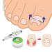 Ingrown Toenail Treatment Kit for Pain Relief - Paronychia Corrector Tool Set for Salon and Home Use - Buy Online on GoSupps.com