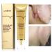 AKARY Acne Scar Removal Cream  Herbal Fade Scar Marks Burns Repair Cream  Stretch Marks Face Skin Cream Shrink Pores Gel  Old and New Scars Skin Repair Gel Skin Care