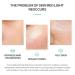 DEleventh Korean Lactobionic Acid Facial Mask 30ml 10pcs | Deep Cleansing Moisturizing Anti-Aging & Anti-Acne Treatment - Shop Internationally - Buy Online on GoSupps.com