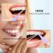 High-Quality Orthodontic Disposable Elastic Bands - 10 Pieces/Bag | Solvent for Orthodontic Cabinets - International Shipping Available - Buy Online on GoSupps.com