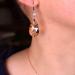Quartz Stone Lymphatic Magnetic Therapy Earrings Lymphvity Germanium Earrings Lymphatic Drainage Slimming Earrings Lymphvity Magnetic Therapy Earrings Lymphatic Drainage Earrings (2Pairs-A) - Buy Online on GoSupps.com