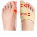 Big Toe Valgus Corrector - Relieve Pain and Align Toe Naturally - Buy Online on GoSupps.com