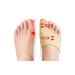 Big Toe valgus corrector