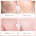 Rose Toner for Face Korean Skincare Rose Smoothing Toner for Face Rose Water Hydrating Facial Toner Smoothing Moisturizing Pore Exfoliating Toner Friendly Vegan - Buy Online on GoSupps.com
