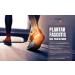 Medium Support 3/4 Length Plantar Fasciitis Insoles - Podiatrist Recommended for Flat Feet, Heel Pain, and Achilles Tendonitis - Size 11-12 UK - Buy Online on GoSupps.com