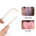 Premium Surgical Stainless Steel Tongue Scraper - Best Oral Care Tool for Adults & Kids - Easy-to-Use Rose Gold Tongue Cleaner - Buy Online on GoSupps.com