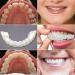 Instant Snap Veneers: Teeth Socket Perfect Braces & Whitening Alternative - No Pain, No Shots, No Drilling (1 Upper + 1 Lower + 2 Adhesives) - Buy Online on GoSupps.com