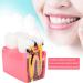 High-Quality Dental Prosthesis Model for Oral Care | International Shipping Available - Buy Online on GoSupps.com