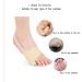 DEAVER Bunion Toe Separator Spreader - Anti-Pain Care Cover for Hallux Valgus - 4 Pairs Small - Buy Online on GoSupps.com