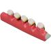 Dental Model for Periodontitis - Realistic Teaching Aid Resin Model for Educational Purposes - Buy Online on GoSupps.com