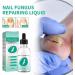 Kerassentials Toenail Fungus Treatment Oil Best Repair Solution for Fingernails and Toenails Fix & Renew Damage Fungal Nail Broken Cracked & Discolored Nails - Buy Online on GoSupps.com