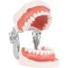 Wudaizhi Dental Model with Removable Teeth - Perfect for Teaching & Practice | International Shipping Available - Buy Online on GoSupps.com