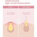 Glam Up Hydrocolloid Acne Patches (108 Counts) - Invisible Ultra Thin Spot Cover Absorbing Pimple Facial Stickers for Zit and Blemishes 2 Sizes 10mm & 12mm - Buy Online on GoSupps.com
