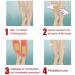 Mandurs 72Pcs Varicose Veins Patch - VeinHealth Treatment for Legs | Improve Blood Circulation, Reduce Pain & Swelling - Buy Online on GoSupps.com