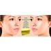 Sulphur Soap 10% Sulfur 200g Avena Sulphur Soap Rid Severe Acne Rosacea - Buy Online on GoSupps.com