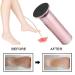 Buy Automatic Electrical Foot Horn Skin Remover - 60 Replacement Grinding Paper Slices - Powerful Pedicure Tool (Pink EU Standard) - Fast International Shipping - Buy Online on GoSupps.com