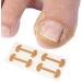 Corrector Patches Ingrown Toenail Kit Straightener Braces Curved - Buy Online on GoSupps.com