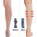 Regular Graduated Compression Sleeves for Men & Women - Firm Support Footless Socks for Varicose Veins Shin Splints Edema Recovery & Diabetic Flights | Hautton - Buy Online on GoSupps.com