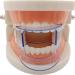 Buy Wudaizhi 5pcs Dental Mouth Retractor Tube Expander - Ideal Mouth Opener for Oral Care | Perfect for Clinics & Home Use - Buy Online on GoSupps.com