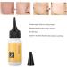 Delicate Skin Scar Treatment Serum - Acne Scar Removal & Repair Cream - 20ml - Buy Online on GoSupps.com