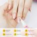 LOPHE 5 Pcs Huile Cuticules Ongles Stylo Stylos Huile pour Cuticules Nail Nutrition Oil Soin Des Ongles Polissoir a Ongle de Traitement pour R parer les Fissures et l'huile de Cuticule S che 5pcs - Buy Online on GoSupps.com