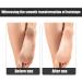 MWUMRCM Callus File Hard and Cracked Dead Skin Beautifier Professional Double Sided Callus Scraper Dead Skin Removal Tool - Buy Online on GoSupps.com