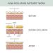 Buy Dermaclara Silicone Stretch Marks Patch Kit - Effective One Patch Solution for Scars | International Shipping Available - Buy Online on GoSupps.com