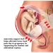 ZiaWorld Care Maternity Pregnancy Support Belt XL Pink | Waist Brace for Back and Abdomen | Post-Partum Belly Band for Women - Breathable and Comfortable - Buy Online on GoSupps.com