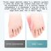 KTROK Thumb Valgus Corrector - Soft Bunion Toe Straightener for Big Toe Alignment - Painless Correction - Easy to Wear - Hallux Valgus Aid - Buy Online on GoSupps.com