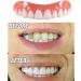 Xzlzmd Artificial Teeth Dentures - Upper & Lower Jaw Repair for Cracked or Missing Prostheses | 6 Pairs for a Perfect Smile - International Shipping - Buy Online on GoSupps.com