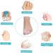 Foot Care Kit: Toe Separators, Gel Sleeves, Alignment Socks & Straightener for Hammer Toes, Bunions & Overlapping Toes - Buy Online on GoSupps.com