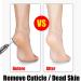 Buy Sanding Disc Nail Drill Bits - Electric Foot File & Pedicure Supplies for Nail Salon | Cuticle & Callus Remover - Buy Online on GoSupps.com
