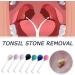 CTDWTNT Right-Angled Glass Cleaning Tool for Tonsil Stones - PVC Suction Ball Manual Cleaner | Teeth Dental Care - Yellow | International Shipping - Buy Online on GoSupps.com